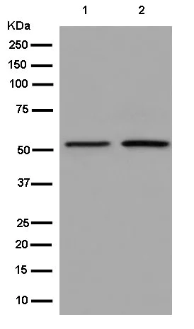 Western blot - Anti-DARS antibody [EPR14846(B)] - BSA and Azide free (AB250552)