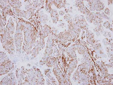 Immunohistochemistry (Formalin/PFA-fixed paraffin-embedded sections) - Anti-DARS2 antibody (AB154606)