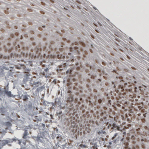 Immunohistochemistry (Formalin/PFA-fixed paraffin-embedded sections) - Anti-DAXX Antibody [CL3580] (AB327116)