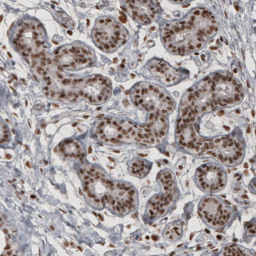 Immunohistochemistry (Formalin/PFA-fixed paraffin-embedded sections) - Anti-DAXX Antibody [CL3580] (AB327116)