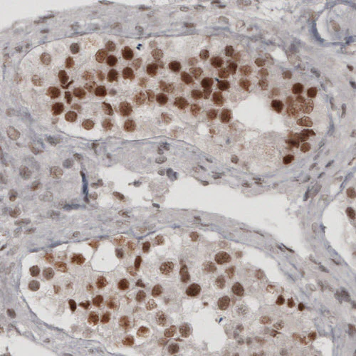Immunohistochemistry (Formalin/PFA-fixed paraffin-embedded sections) - Anti-DAXX Antibody [CL3580] (AB327116)