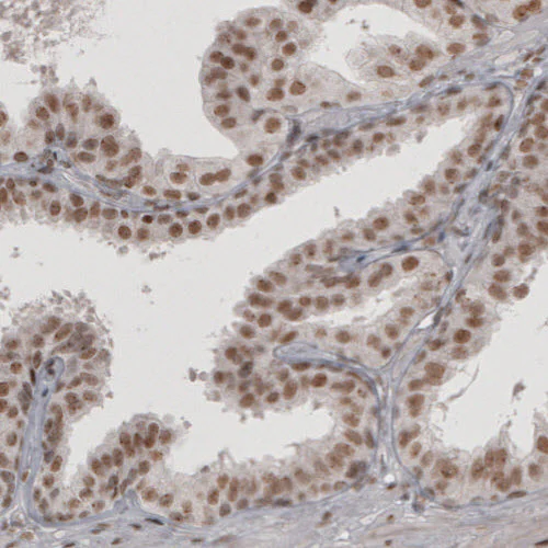 Immunohistochemistry (Formalin/PFA-fixed paraffin-embedded sections) - Anti-DAXX Antibody [CL3580] (AB327116)