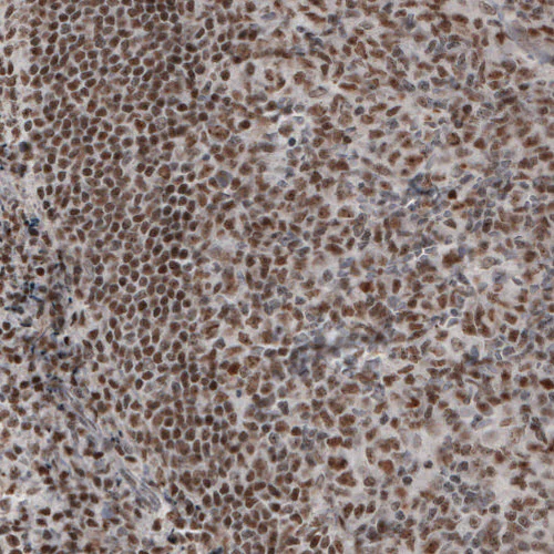 Immunohistochemistry (Formalin/PFA-fixed paraffin-embedded sections) - Anti-DAXX Antibody [CL3580] (AB327116)