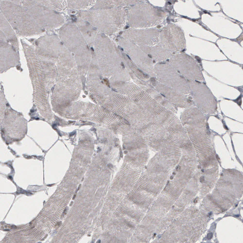 Immunohistochemistry (Formalin/PFA-fixed paraffin-embedded sections) - Anti-DAXX Antibody [CL3580] (AB327116)