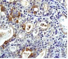 Immunohistochemistry (Formalin/PFA-fixed paraffin-embedded sections) - Anti-Daxx antibody [E94] - BSA and Azide free (AB239806), expandable thumbnail