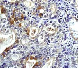 Immunohistochemistry (Formalin/PFA-fixed paraffin-embedded sections) - Anti-Daxx antibody [E94] - BSA and Azide free (AB239806)