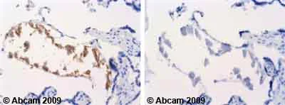 Immunohistochemistry (Formalin/PFA-fixed paraffin-embedded sections) - Anti-Daxx (phospho S668) antibody (AB55323)