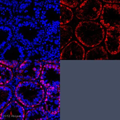 Immunohistochemistry (Formalin/PFA-fixed paraffin-embedded sections) - Anti-DAZL antibody (AB34139)