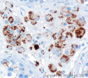 Immunohistochemistry (Formalin/PFA-fixed paraffin-embedded sections) - Anti-DAZL antibody (AB34139)
