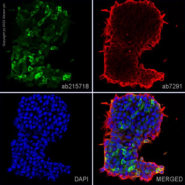 Immunocytochemistry/ Immunofluorescence - Anti-DAZL antibody [EPR21028] (ab215718), expandable thumbnail