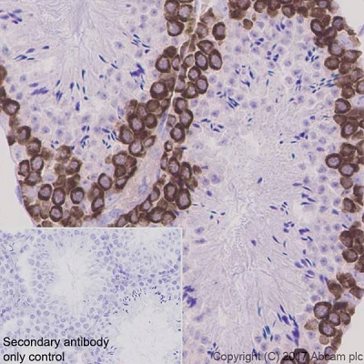 Immunohistochemistry (Formalin/PFA-fixed paraffin-embedded sections) - Anti-DAZL antibody [EPR21028] (ab215718), expandable thumbnail