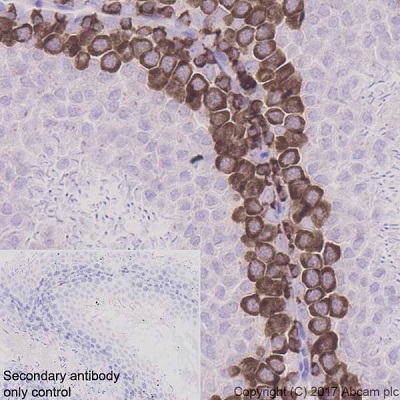 Immunohistochemistry (Formalin/PFA-fixed paraffin-embedded sections) - Anti-DAZL antibody [EPR21028] (ab215718), expandable thumbnail