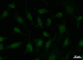 Immunocytochemistry - Anti-DB1 antibody [ZNF5J141] (AB50970)