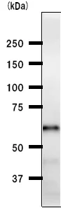 Western blot - Anti-DB1 antibody [ZNF5J141] (AB50970)