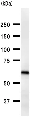 Western blot - Anti-DB1 antibody [ZNF5J141] (AB50970)