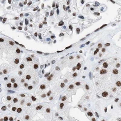 Immunohistochemistry (Formalin/PFA-fixed paraffin-embedded sections) - Anti-DBC-1 antibody (AB244377)