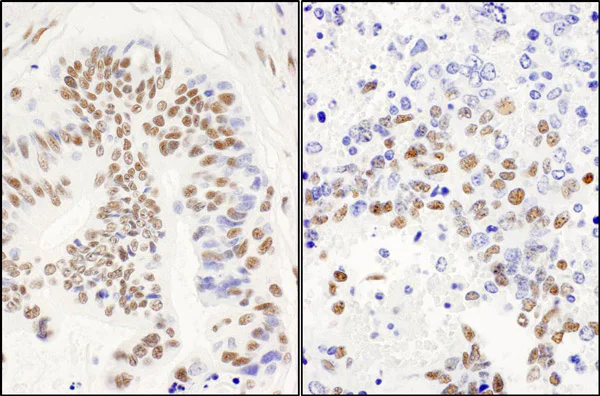 Immunohistochemistry (Formalin/PFA-fixed paraffin-embedded sections) - Anti-DBC-1 antibody (AB70239)