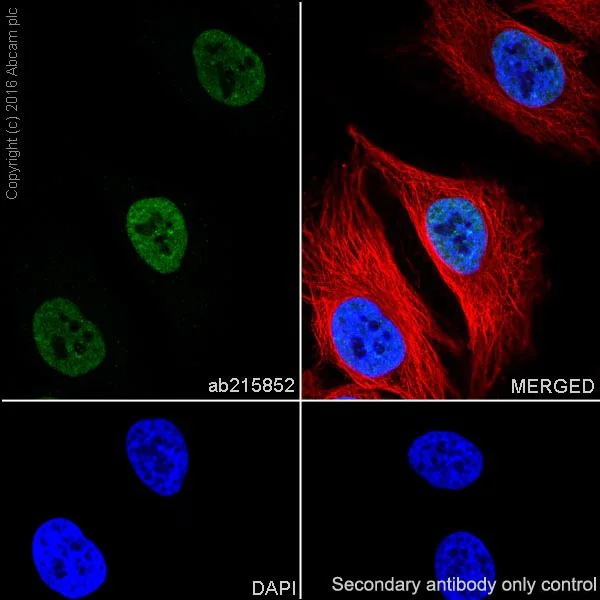 Immunocytochemistry/ Immunofluorescence - Anti-DBC-1 antibody [EPR19747] - BSA and Azide free (AB223530)