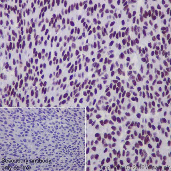 Immunohistochemistry (Formalin/PFA-fixed paraffin-embedded sections) - Anti-DBC-1 antibody [EPR19747] - BSA and Azide free (AB223530)