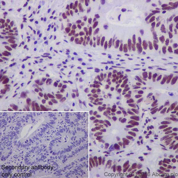 Immunohistochemistry (Formalin/PFA-fixed paraffin-embedded sections) - Anti-DBC-1 antibody [EPR19747] - BSA and Azide free (AB223530)
