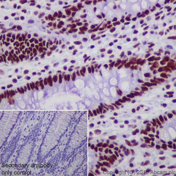 Immunohistochemistry (Formalin/PFA-fixed paraffin-embedded sections) - Anti-DBC-1 antibody [EPR19747] - BSA and Azide free (AB223530)