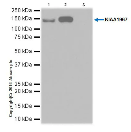 Immunoprecipitation - Anti-DBC-1 antibody [EPR19747] - BSA and Azide free (AB223530)