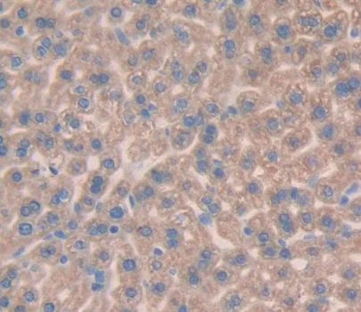 Immunohistochemistry (Formalin/PFA-fixed paraffin-embedded sections) - Anti-DBI antibody (AB231910)
