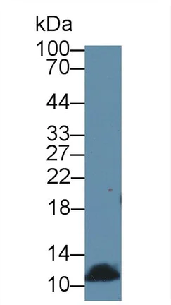 Western blot - Anti-DBI antibody (AB231910)