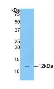 Western blot - Anti-DBI antibody (AB231910)