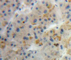Immunohistochemistry (Formalin/PFA-fixed paraffin-embedded sections) - Anti-DBI antibody (AB232760)