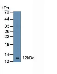Western blot - Anti-DBI antibody (AB232760)