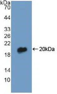 Western blot - Anti-DBI antibody (AB232760)