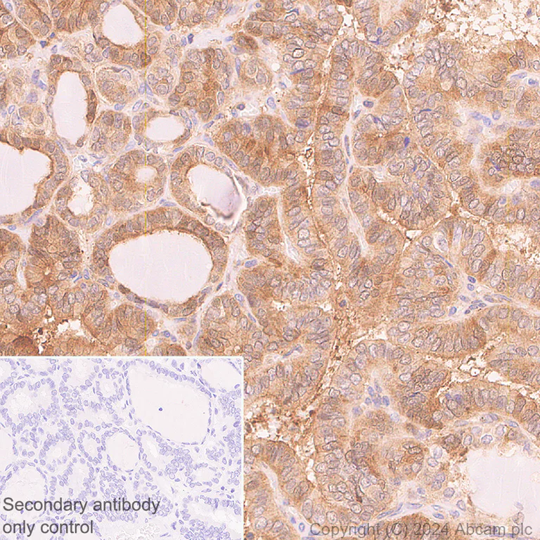 Immunohistochemistry (Formalin/PFA-fixed paraffin-embedded sections) - Anti-DBI antibody [EPR28926-2] (AB317823)