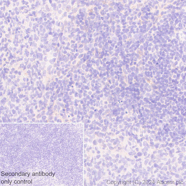 Immunohistochemistry (Formalin/PFA-fixed paraffin-embedded sections) - Anti-DBI antibody [EPR28926-2] (AB317823)