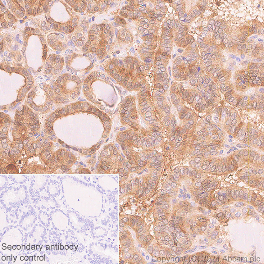 Immunohistochemistry (Formalin/PFA-fixed paraffin-embedded sections) - Anti-DBI antibody [EPR28926-2] - BSA and Azide free (AB317824)