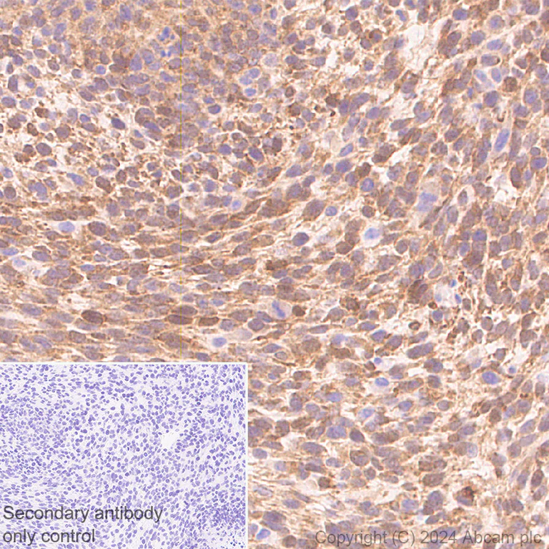 Immunohistochemistry (Formalin/PFA-fixed paraffin-embedded sections) - Anti-DBI antibody [EPR28926-2] - BSA and Azide free (AB317824)