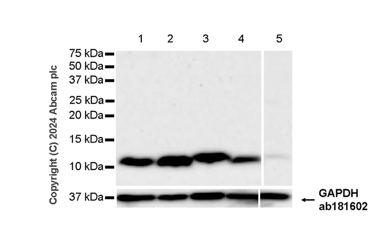 Western blot - Anti-DBI antibody [EPR28926-2] - BSA and Azide free (AB317824)