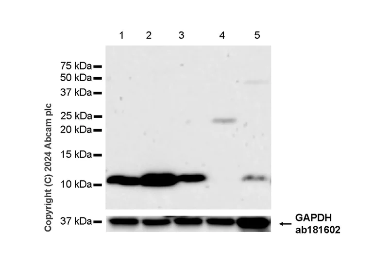 Western blot - Anti-DBI antibody [EPR28926-2] - BSA and Azide free (AB317824)