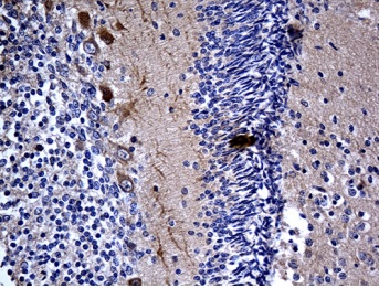 Immunohistochemistry (Formalin/PFA-fixed paraffin-embedded sections) - Anti-DBL antibody [OTI2C12] (AB236398)