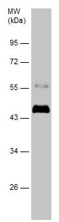 Western blot - Anti-DBPA antibody - C-terminal (AB227591)
