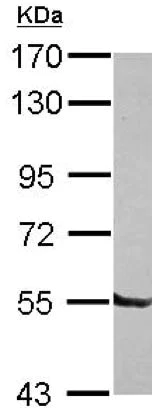 Western blot - Anti-DBR1 antibody (AB154230)
