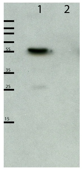 Western blot - Anti-DBR1 antibody (AB154230)