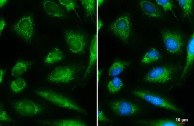 Immunocytochemistry/ Immunofluorescence - Anti-DBT antibody (AB151991)