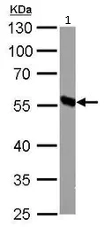 Western blot - Anti-DBT antibody (AB151991)