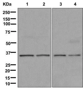 Western blot - Anti-dbx2 antibody [EPR12633(B)] - BSA and Azide free (AB249975)