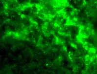 Immunocytochemistry/ Immunofluorescence - Anti-DC-SIGN antibody (AB5715)