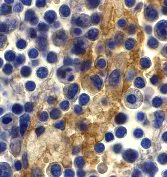 Immunohistochemistry (Formalin/PFA-fixed paraffin-embedded sections) - Anti-DC-SIGN antibody (AB5715)