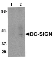 Western blot - Anti-DC-SIGN antibody (AB5715)