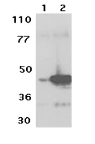 Western blot - Anti-DC-SIGN antibody (AB5715)