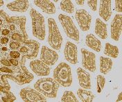Immunohistochemistry (Formalin/PFA-fixed paraffin-embedded sections) - Anti-DC-SIGN antibody (AB5716)